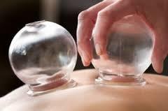 Other complementary therapies such as cupping may be used with dry needling to give an enhanced therapeutic effect for pain and injury care.