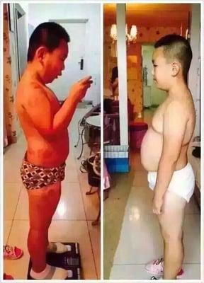 A 12 years old boy lost 18 pounds in two months