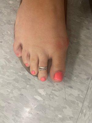 Big toe is crooked. Messy polish.