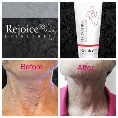 Spa owner Dana Middleton has developed her own skincare line Rejoice R3 Skincare. If you want to see a change in your skin then you must try