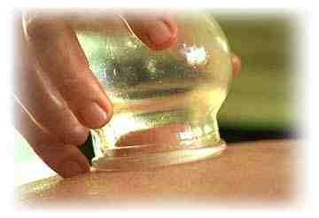 Cupping Therapy - For Pain, Colds, Cough