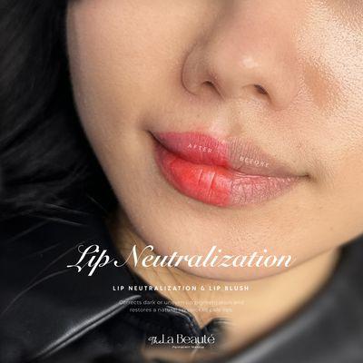 Lip Neutralization