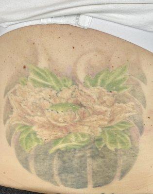 Removery Tattoo Removal & Fading