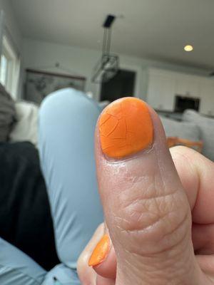 Horrible nail turnout