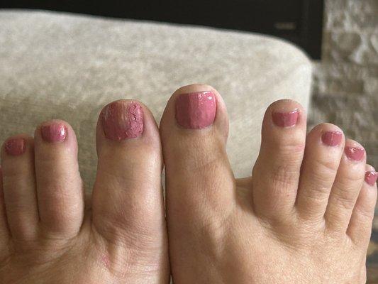 Pedicure results from Rosy's