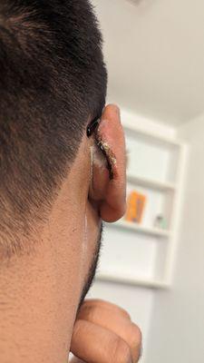 Ear cut