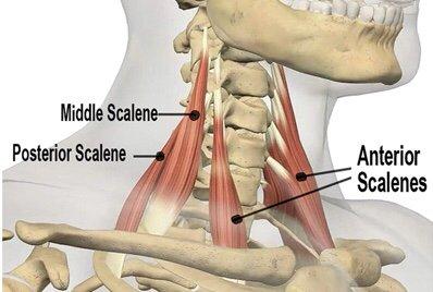 When these muscles are tight it causes headaches, arm pain and numbness along with other symptoms.