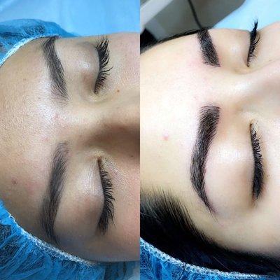 Microblading