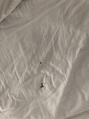 Blood on 2 of the sets of sheets. Sand in 3 of the beds.