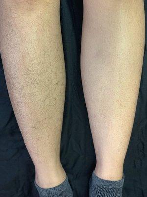 Before & after leg wax