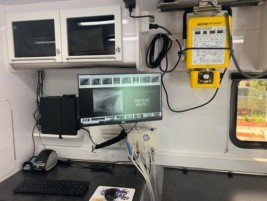 Digital radiography equipment