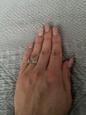 My nails 2 week of grow out (will get backfill in 2 weeks)