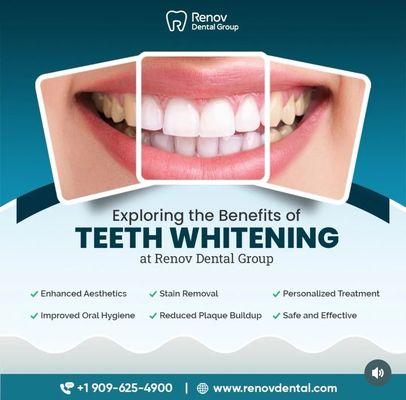 Teeth whitening