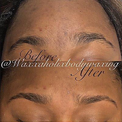 Brow shaping