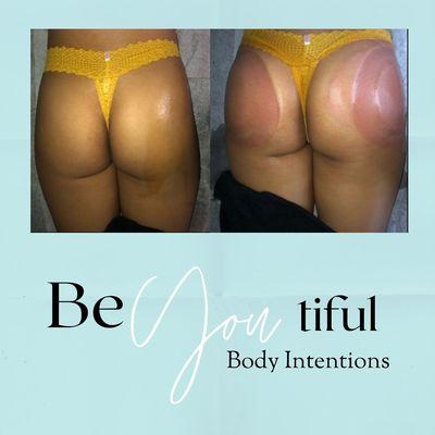 Beyoutiful Body Intentions