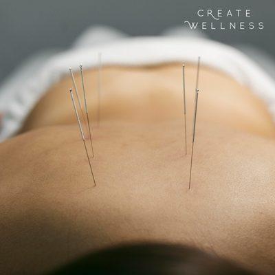 Dr. Linda is an  exceptional acupuncturist