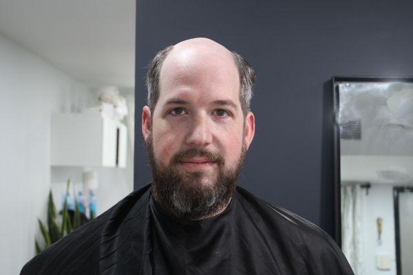 Before: Client 5