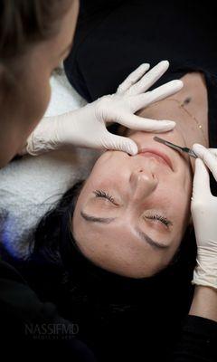 Dermaplaning exfoliates your skin and removes "peach fuzz"