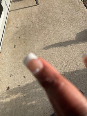 Nail coming off