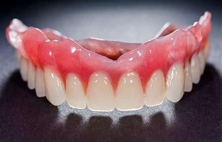 Custom Dentures