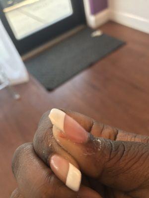 Thumb cut deep