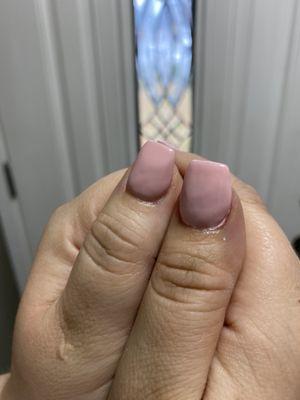 Lump bumpy nails