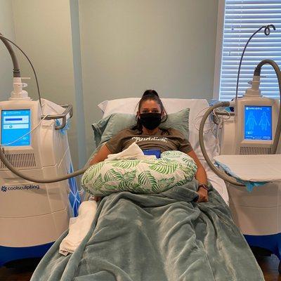 Coolsculpting in progress!