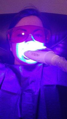 Teeth whitening