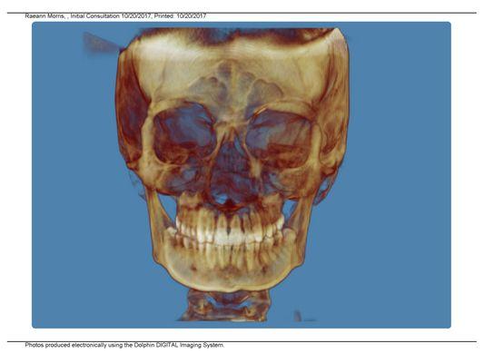 Our company utilizes technology to produce three dimensional (3-D) images of your teeth, soft tissues, and bone in one scan.