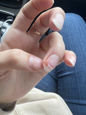 How damaged my nail is now