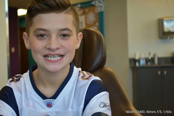 I have Invisalign my son just got braces on, great experience, no other office can match up to the expertise by Dr. DANIELS!