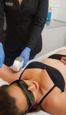 laser treatment