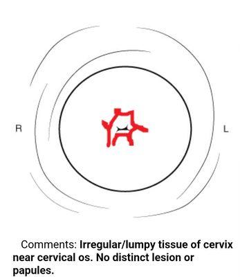 Injuries to my cervix after procedure at Arcadia Well Woman