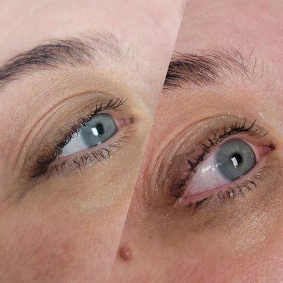 Eyelash lift