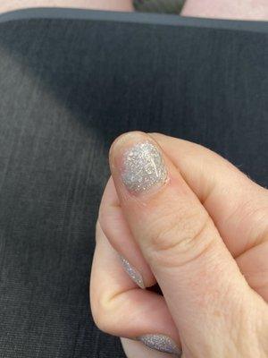 Messed up nail