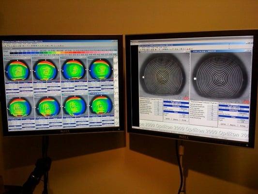 Corneal topography maps