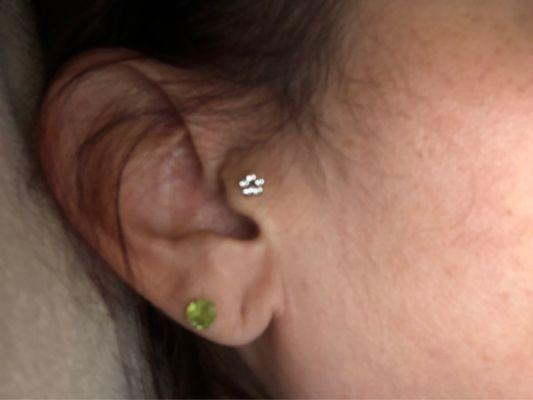 Tragus