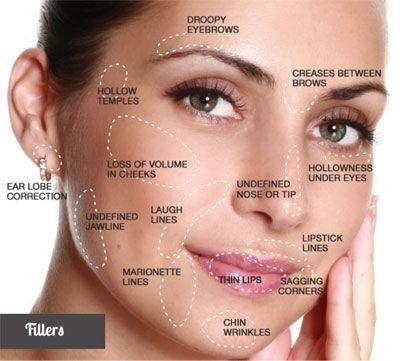 Cosmetic Fillers