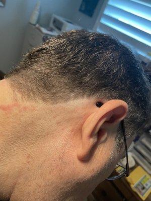 Multiple nicks on both sides of back of head