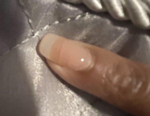 I also have cracks starting to appear on my pinkie. The smaller cracks don't show in the pic but the large crack is over my real nail bed.