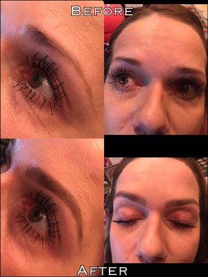 Brow shaping