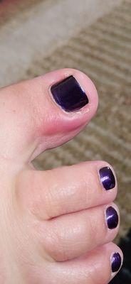 Here is my toe a week later. Swollen and red, where she dug into my nail, and I bled.