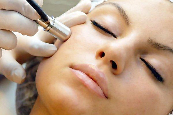 Microdermabrasion treatment for only $65