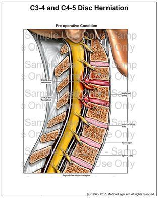 Medical Illustrations - Custom and Stock images