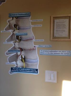 We adjust Subluxations at Rhino Chiropractic!