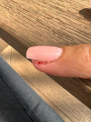 Cuticle nippers and cuticle drilling left me bleeding.