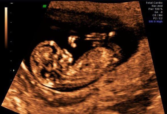 Advanced Ultrasound Services