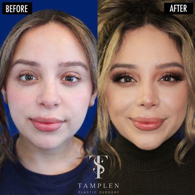 Tamplen Plastic Surgery 