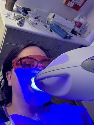 Zoom Teeth Whitening