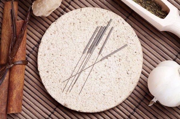 Acupuncture needles